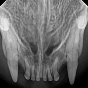 Dina upper canines_incisors