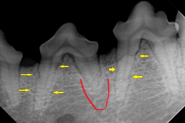 307 308 root changes